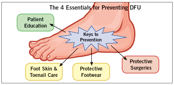 Preventing Diabetic Foot Complications: A Guide for Patients